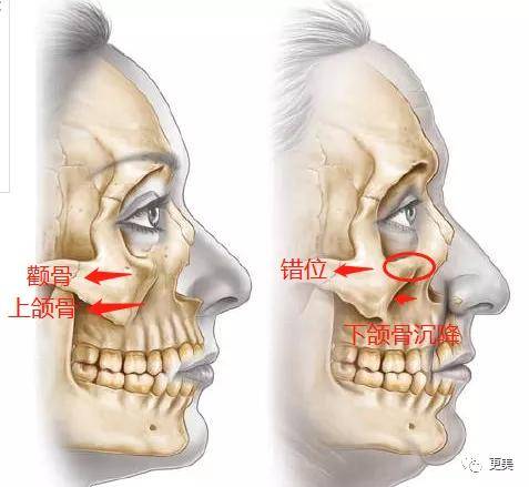 面部|韩国小姐冠军出炉，和王思聪前女友撞医生，才22岁就老了...