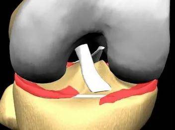 如何挑选大骨头 3188f9217d2f4089a54e934e3b912167.jpeg