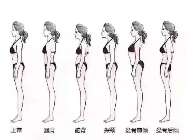 骨盆前倾与骨盆后倾该如何来调整