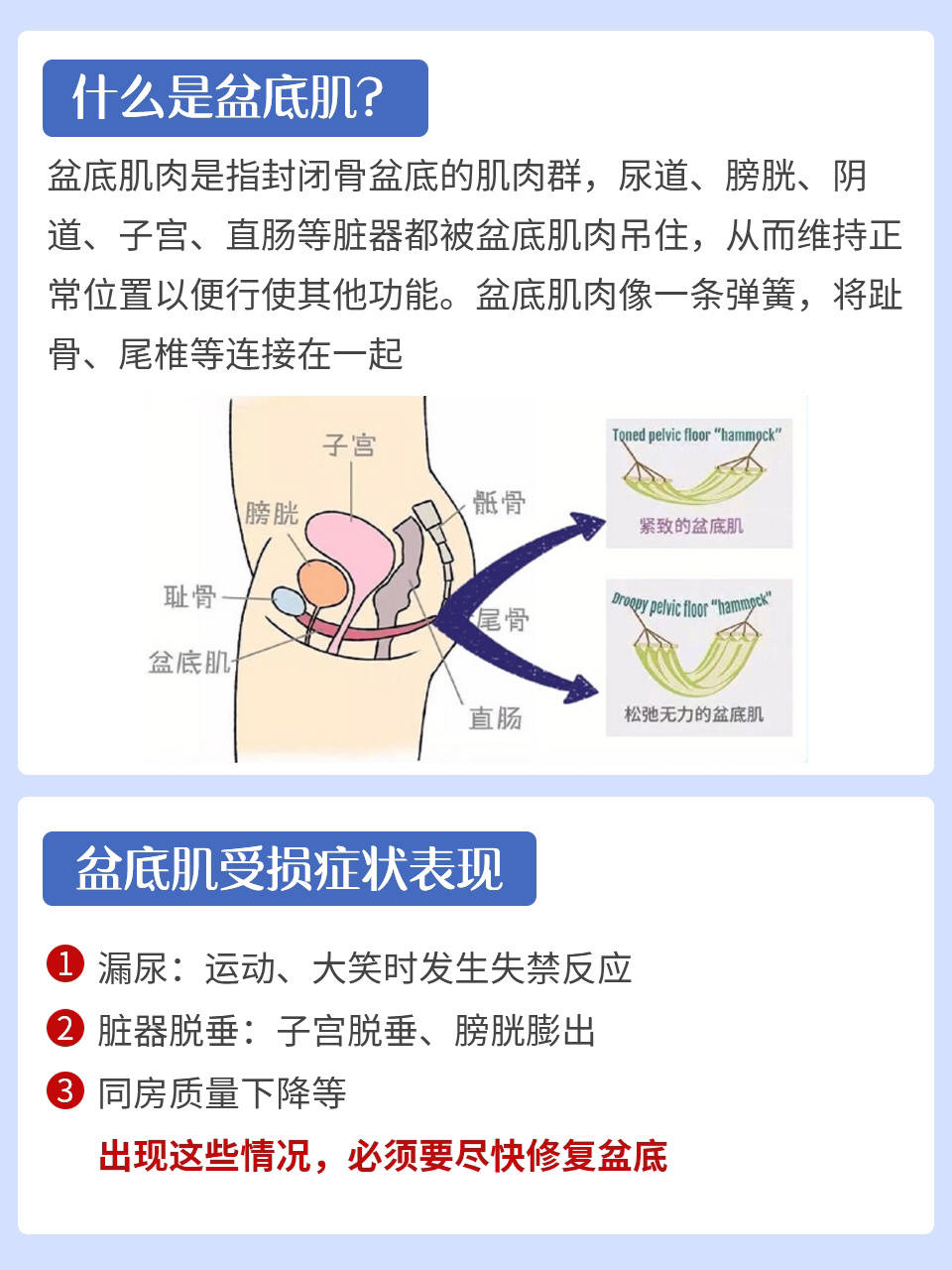 产后盆底肌修复,重回少女身材内附图解