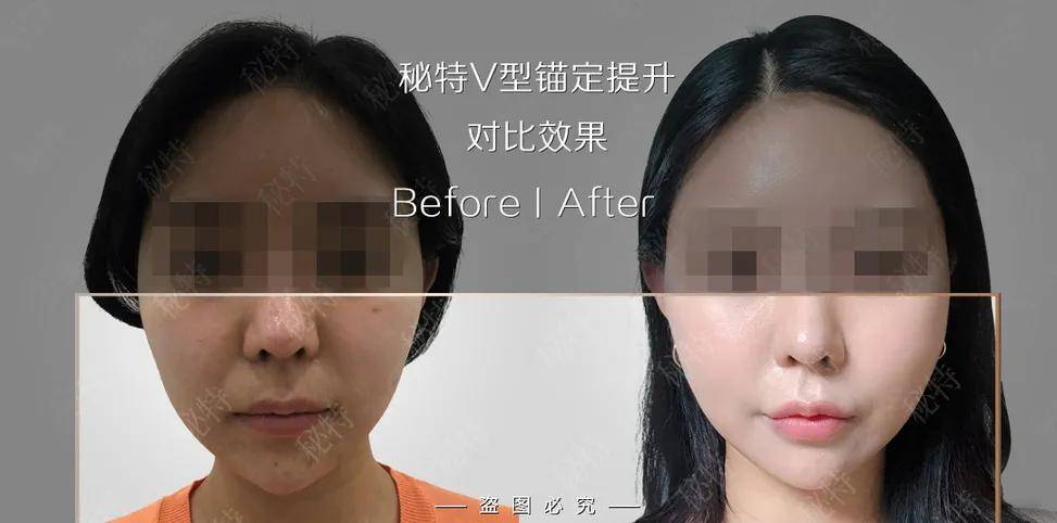 老脸|金晨谈恋爱也太尴尬了！节目组卖力撮合个寂寞……这张不老脸就能胡作非为吗？