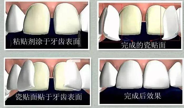 李沁|又一对顶流即将官宣？