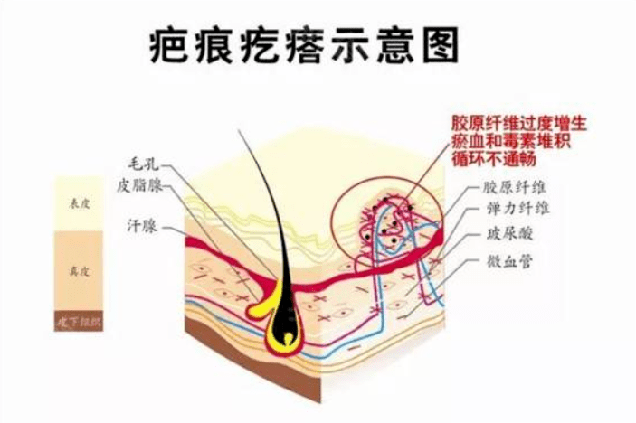 王岳伦|李湘这是要让王岳伦净身出户？不愧是脑子清醒有手段的她...