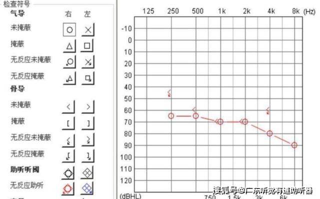 教你学会看听力图