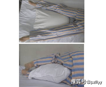 科普系列:骨科主任黄兴华为您介绍髋关节置换患者术后注意事项