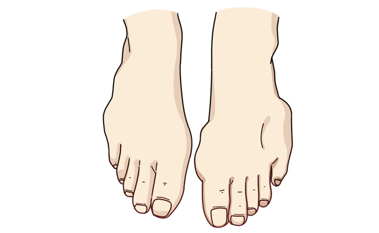 肾结石一般多大年龄得的 2e79e4ffaa9b429f8d513d193e04a82b.png