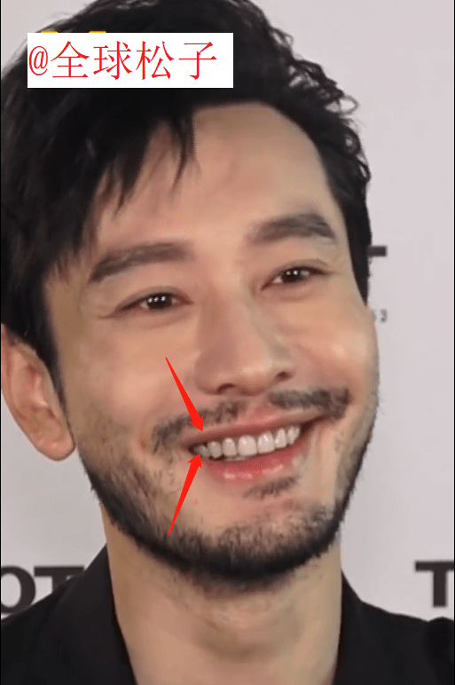 黄晓明留络腮胡男人味十足,牙齿上的"黑点"引人注目