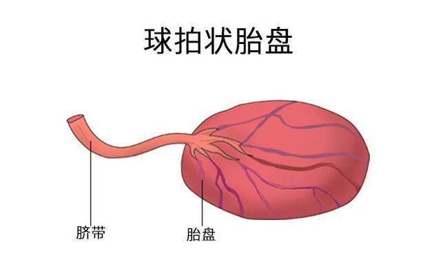 单脐动脉怎么办