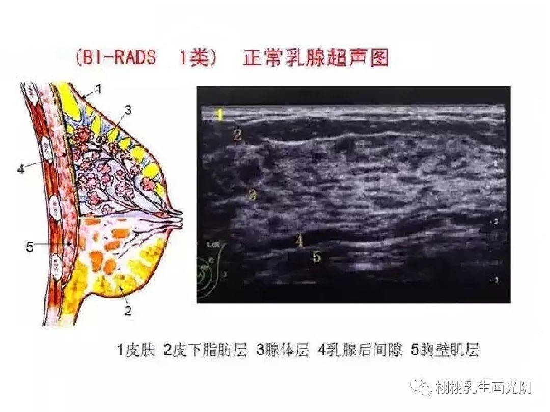 乳房结节,需要手术吗