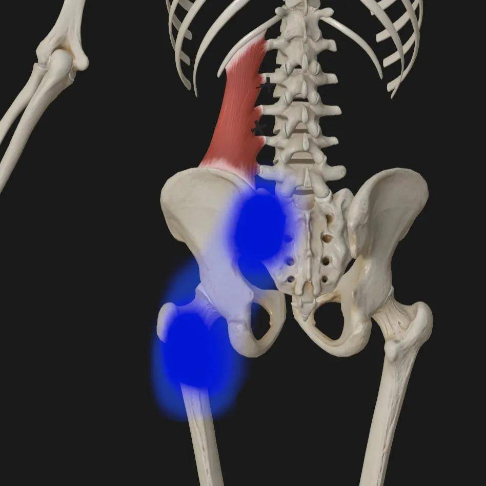 腰方肌内侧触发点源于腰方肌触发点的疼痛可能会出现在髋部,臀部以及