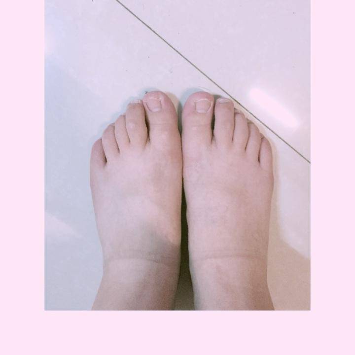 "不一般"的脚型,如何选到又有颜值又舒适的鞋?