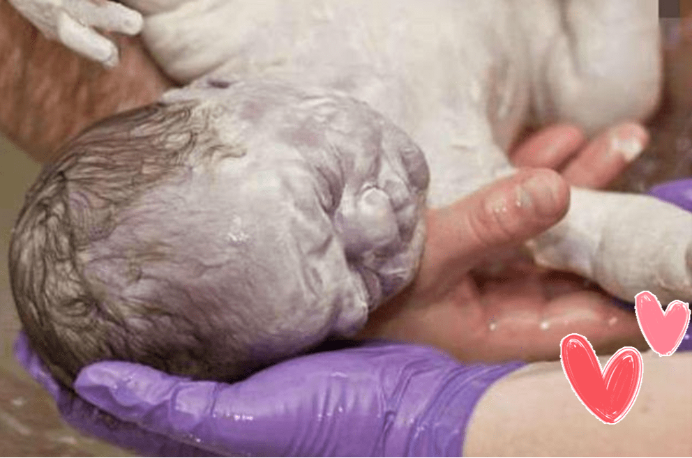 胎毛|新生宝宝胎脂胎毛该咋处理？父母须看“真丑！生了个毛娃娃”