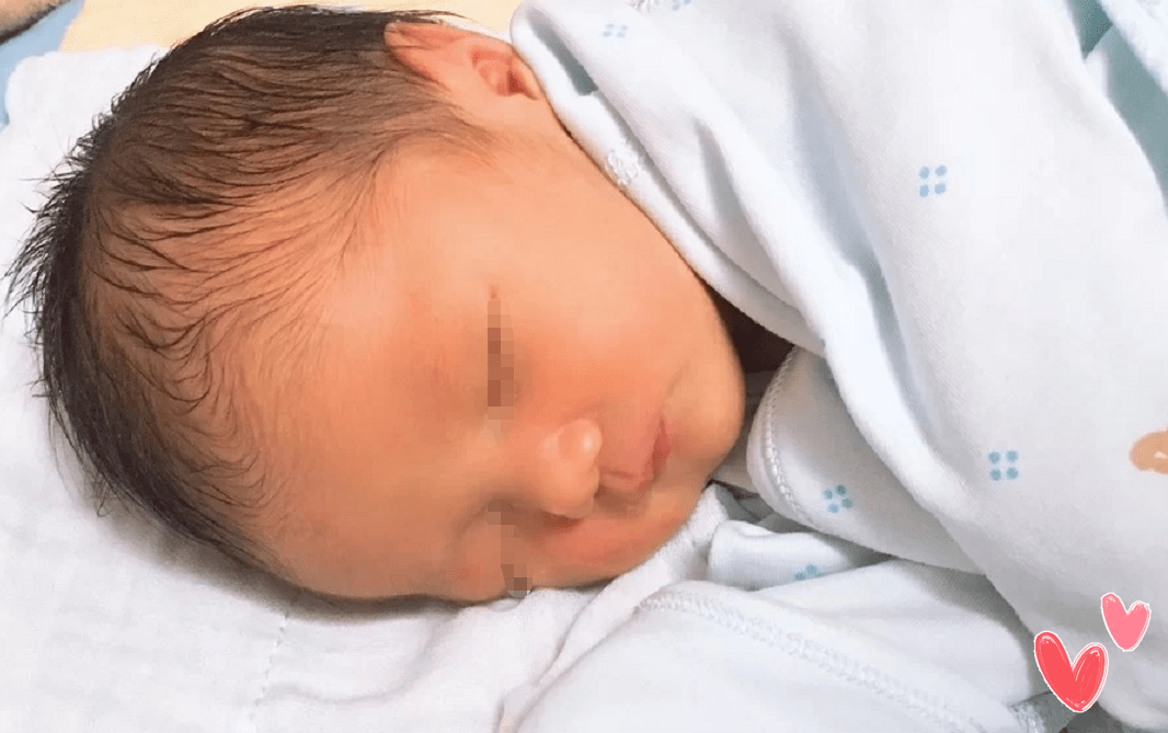 胎毛|新生宝宝胎脂胎毛该咋处理？父母须看“真丑！生了个毛娃娃”