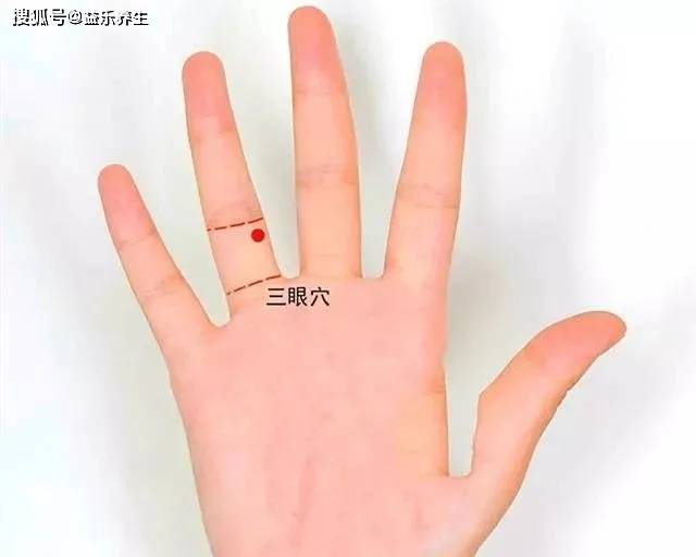董氏针灸 止涎穴 眼黄穴 三眼穴