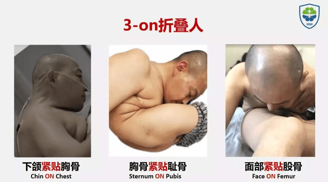 易感人口_易感人群图片(3)