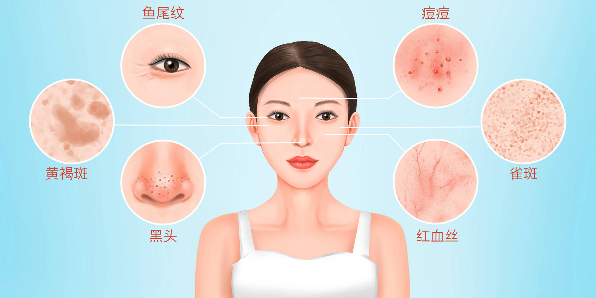 激光美容可以解决哪些皮肤问题？