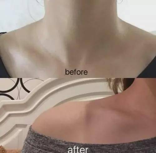 怎么拥有直角肩和锁骨 cd48d788d46e4f0ea25797f71937b447.jpeg