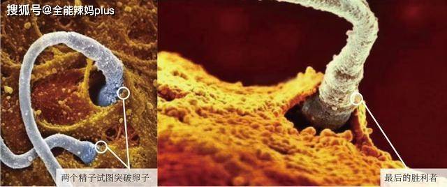 怎么快速排出卵子 7f4cbe1ac9774f73b49b39d95a65b731.jpeg