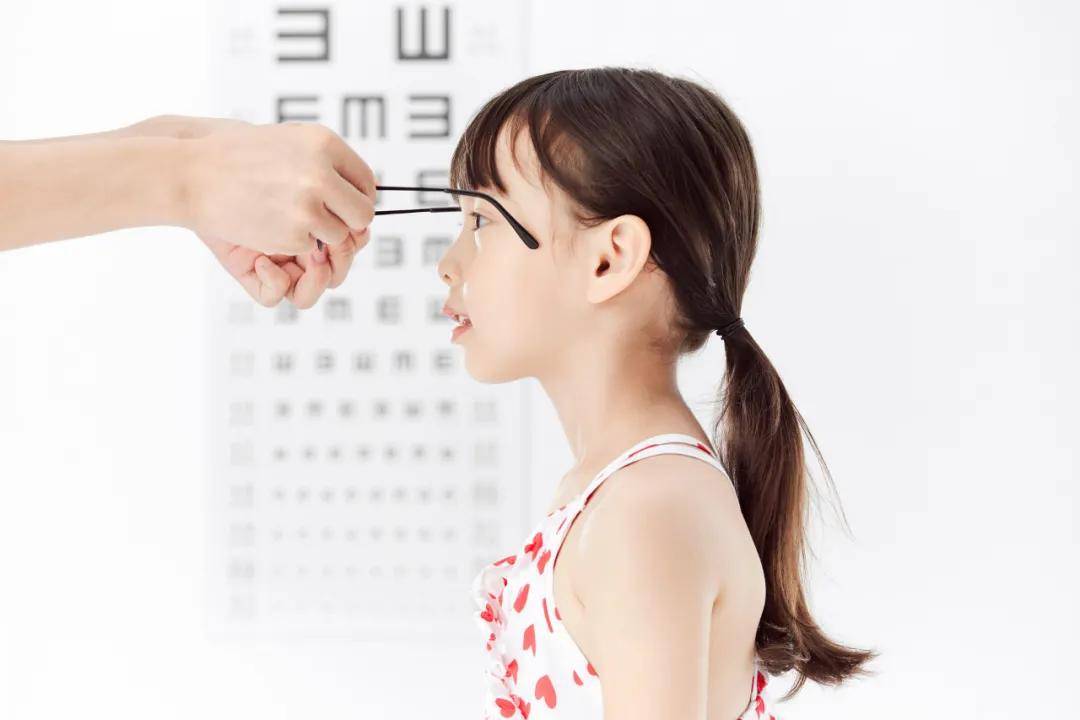 斜视人口_眼睛斜视图片(3)