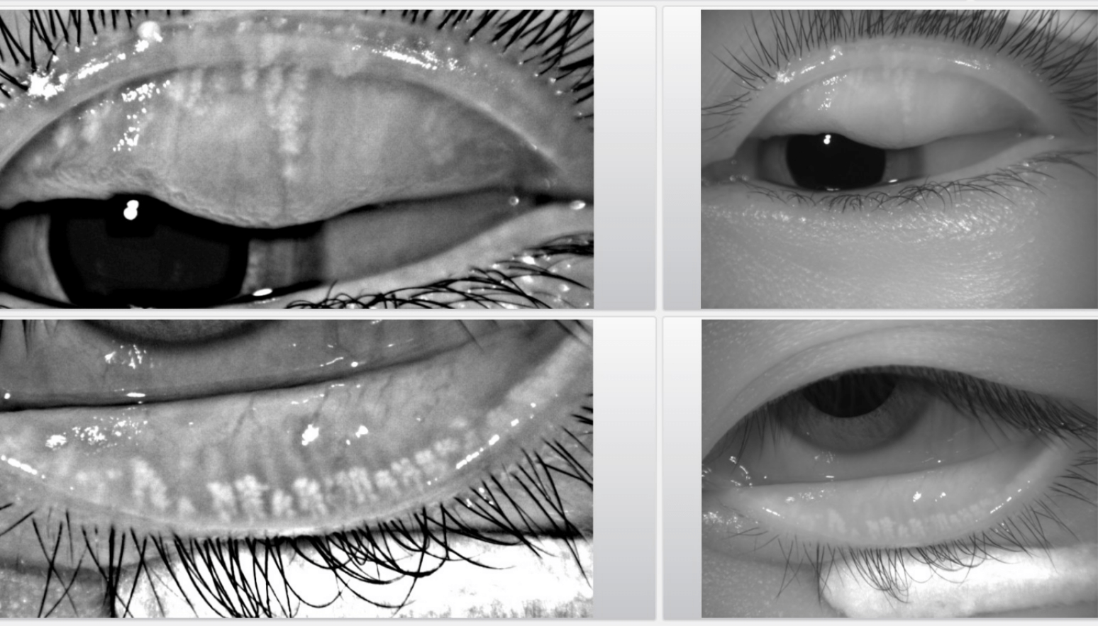 10.眼球和眶腔的矢状切面-眼耳鼻咽喉应用解剖-医学