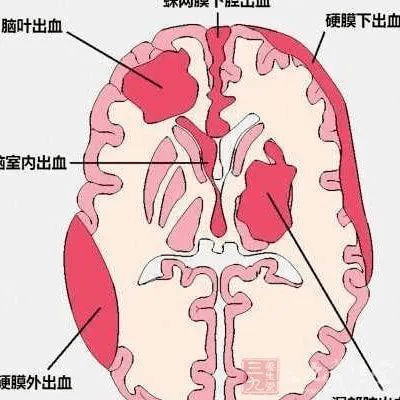 ac89842cbd0e4a6e895f757f06a92e4f.png
