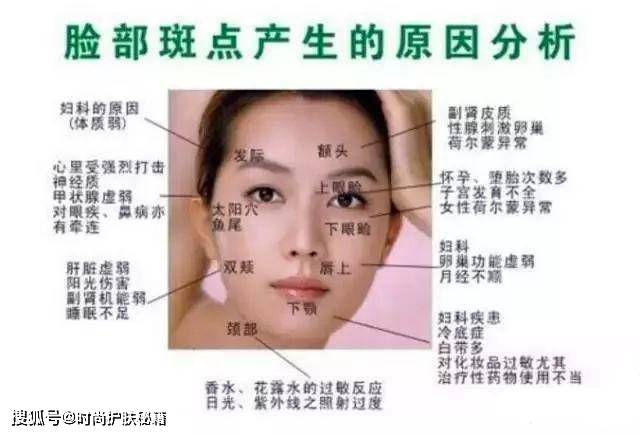 女人脸上的斑点可能与疾病有关