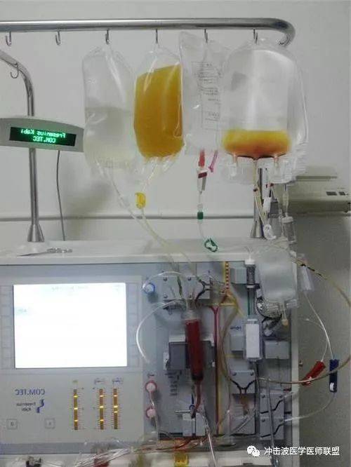 德国费森尤斯智能双重血液净化系统血细胞分离技术