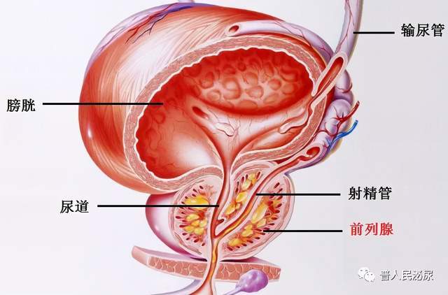 如何养护前列腺psa增高就一定是前列腺癌吗