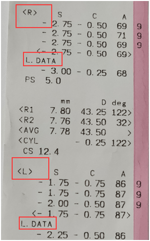 一分钟教你看懂验光单