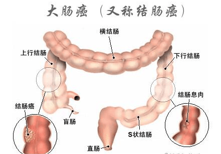 喝什么有助于肠胃蠕动 cdb099be303f46499c464067cc6ca7dc.png