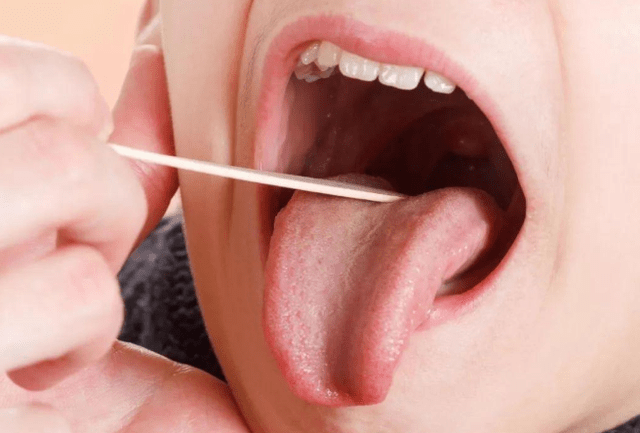 梦境解析,下齿脱落与舌头顶触的深层含义 梦境解析,下齿脱落与舌头顶触的深层含义