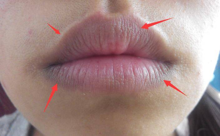 注意观察的话可以发现,基本上没有人的正常嘴唇是发黑的,若你的唇唇