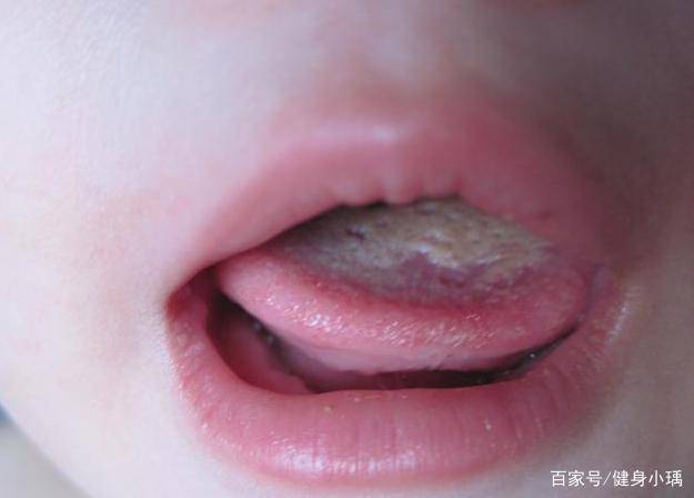六岁半男童脾虚衰竭,儿科主任:这4种症状别忽视,事关孩子!