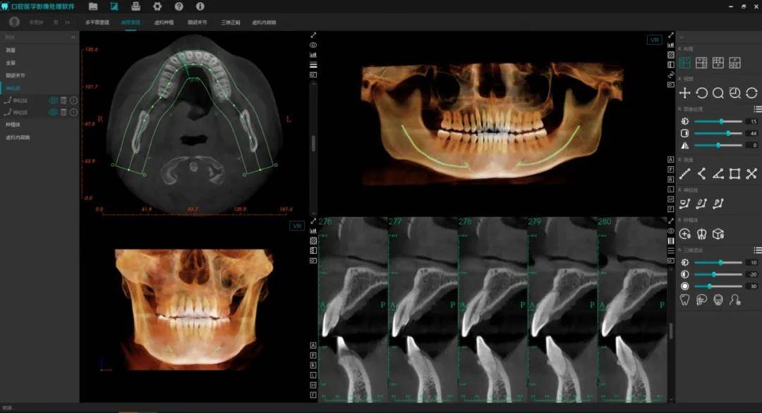 美亚口腔cbct—全景持续热销的背后,是全新一代美亚口腔cbct优异