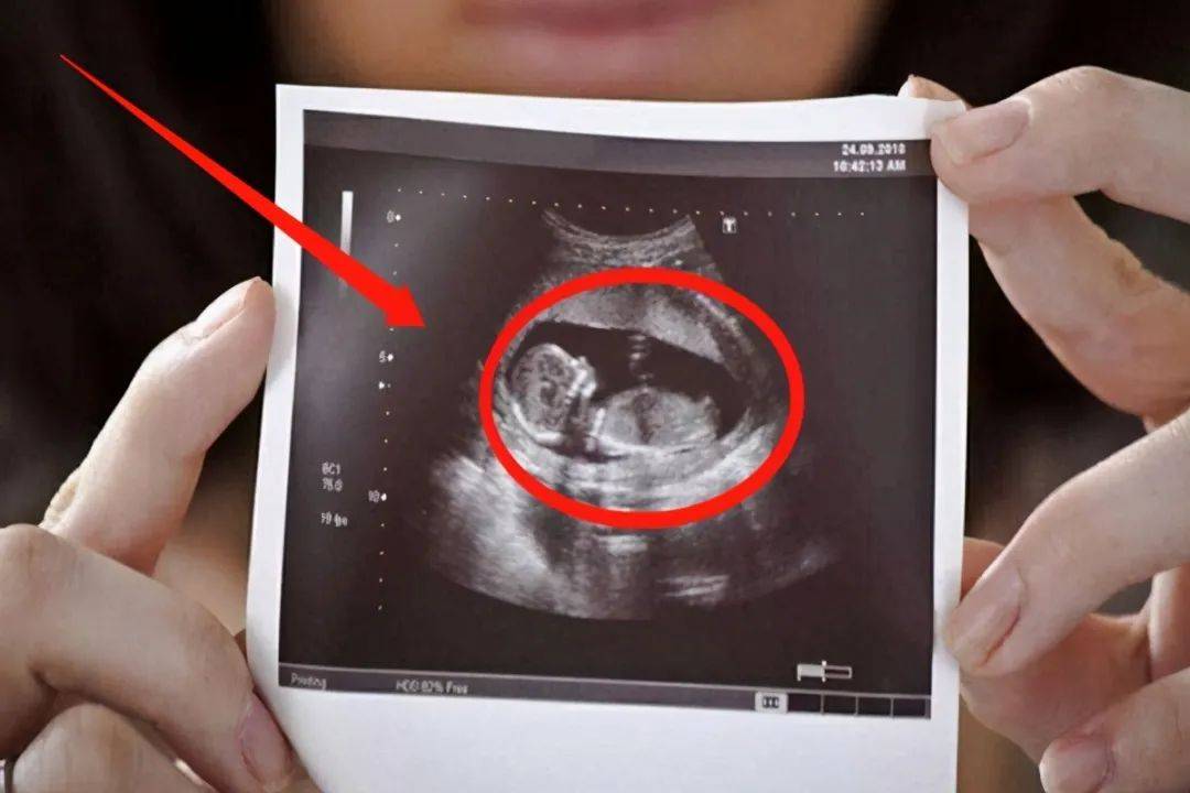 孕晚期胎儿活泼好动处于孕晚期的妈妈们如果去检查宝宝性别的话,很