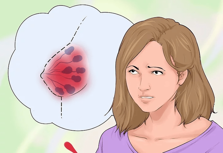 乳腺增生有哪些症状,为什么会得乳腺增生?