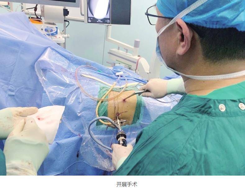 微创保髋——衡水市人民医院开展一台治疗股骨头坏死手术纪实