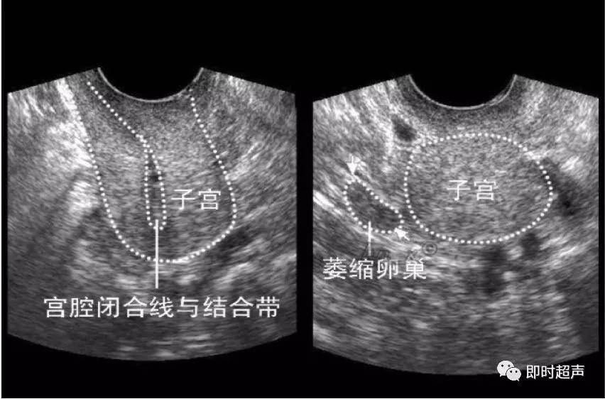 各时期女性生殖器官超声表现