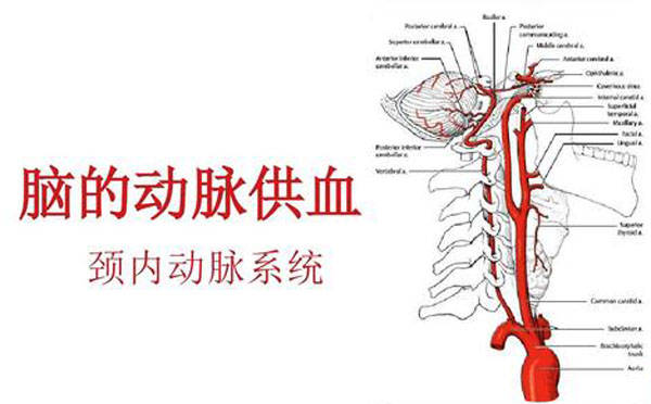 老人脑梗反复头晕查出颈内动脉狭窄如何预防颈动脉斑块
