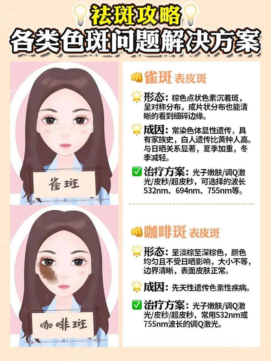 色斑为什么难治一篇告诉你不同类型的色斑都该怎么祛