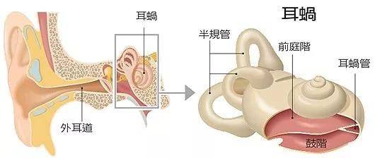 梅尼埃病(md)是一种原因不明的,以耳蜗内膜迷路积水为主要病理特征的