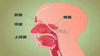 鼻窦又称鼻旁窦,是鼻腔周围骨壁内的一些含气的空腔