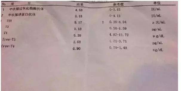 关于"桥本氏甲状腺炎"那些事