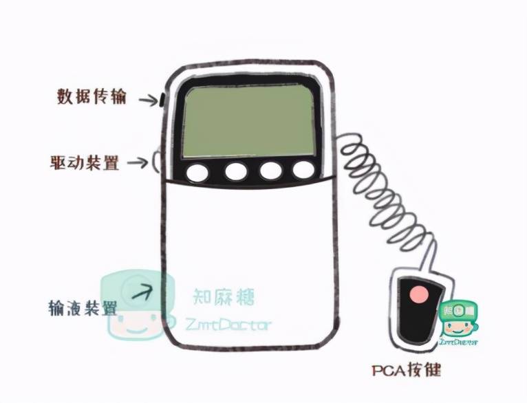 就可以自己按一下镇痛装置的追加药按钮,以达到镇痛的目的