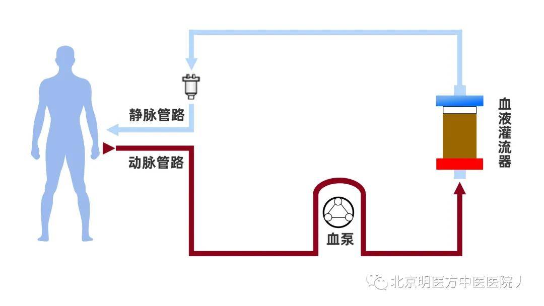 血液净化】时