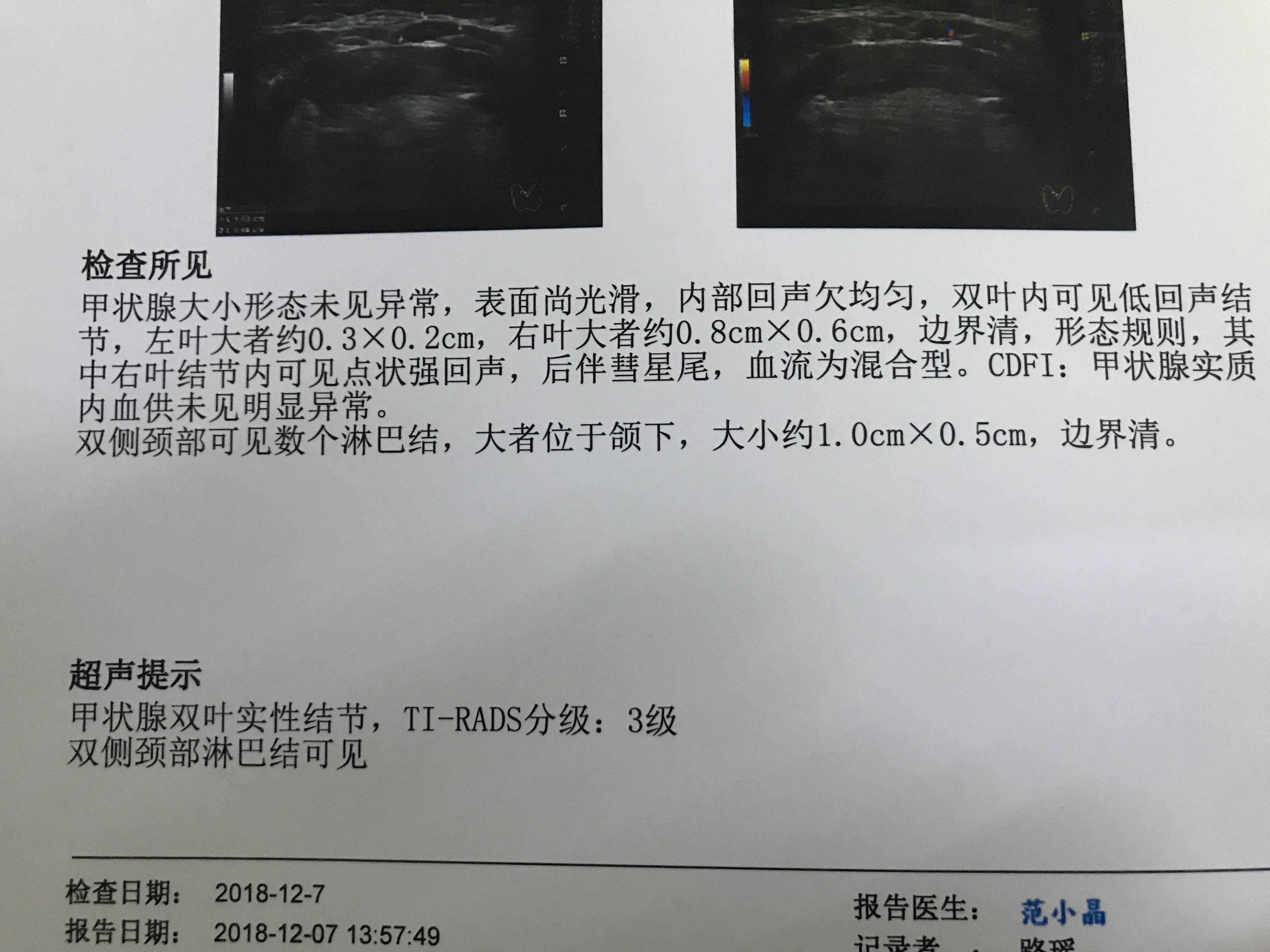 北京和平里史常梅专家:教你看懂甲状腺超声报告