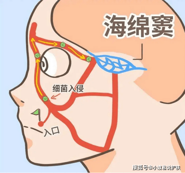 鼻子和嘴角组成的一个三角形的区域 就是所谓的"危险三角区" "危险