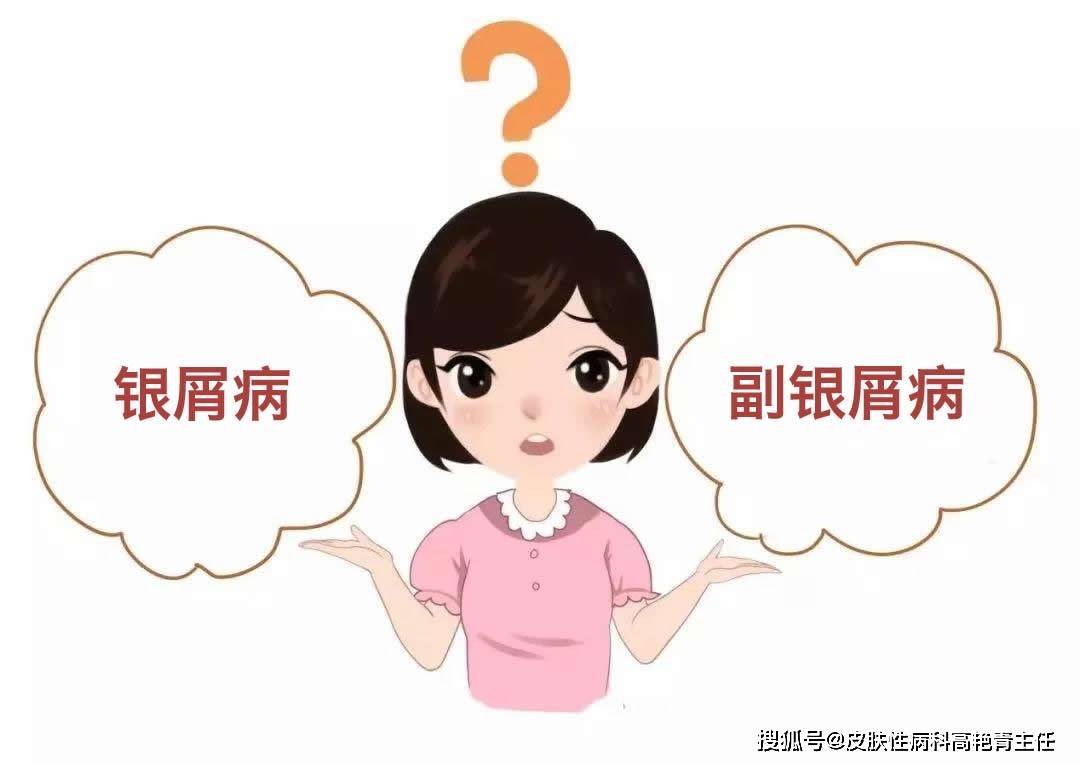 副银屑病跟银屑病有什么区别?确诊后该怎么办?