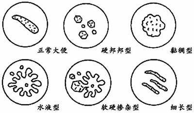 长期大便不成形,屁还多?3个原因在"作怪,不是小事,别拖