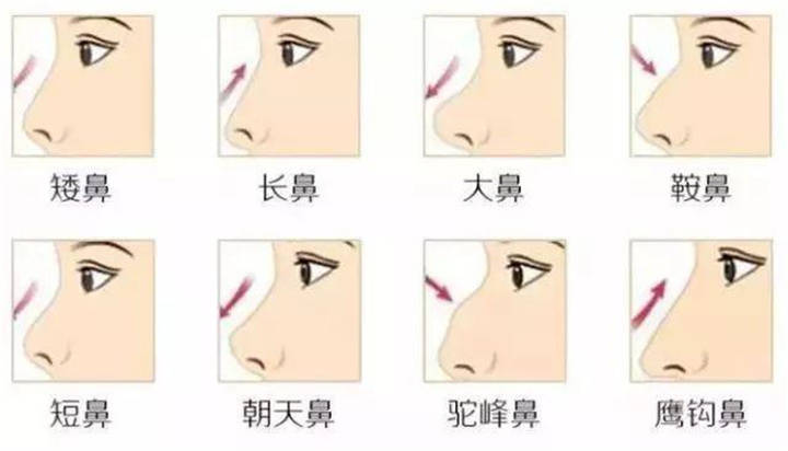 国人常见鼻型有八种:矮鼻,长鼻,大鼻,鞍鼻,短鼻,朝天鼻,驼峰鼻及
